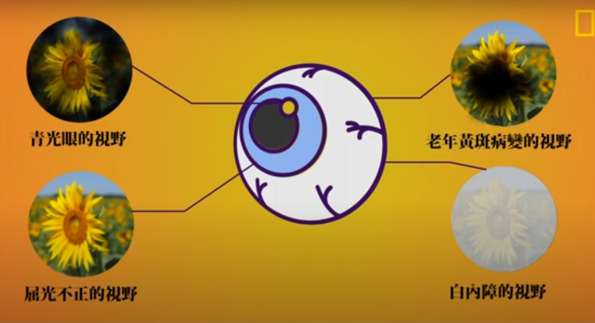 視力